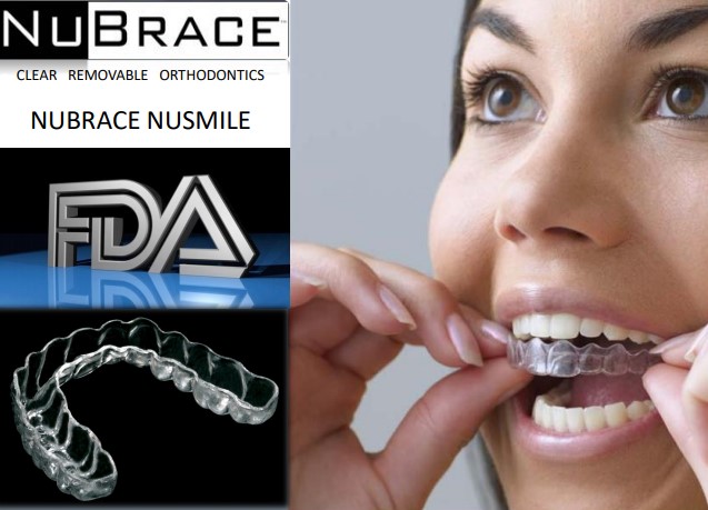 NUBRACE CLEAR ORTHODONTICS